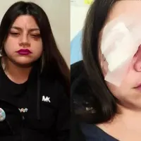 «Me dejaron muerta en vida»: El crudo relato de la joven que perdió la visión de su ojo por culpa de un Arengazo