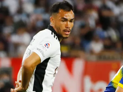 [Foto]: Choque en entrenamiento terminó con Gabriel Suazo en el dentista